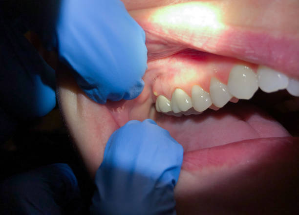Best Emergency Dentist for Special Needs Patients in Folly Beach, SC